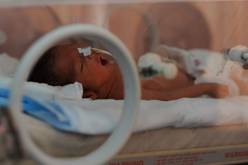 Close-up of a premature newborn baby's face inside a NICU crib at Be Team International's Cure Hospital in Kabul, Afghanistan, seen through the crib's access opening